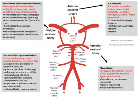 Stroke | OSCEstop | OSCE Learning