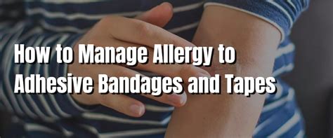 How to Manage Allergy to Adhesive Bandages and Tapes – MY Healthy Balance