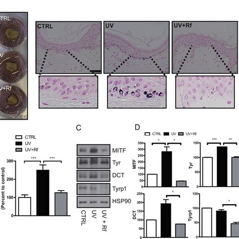 Rf reduced melanogenesis in UV irradiation-stimulated ex vivo human ...