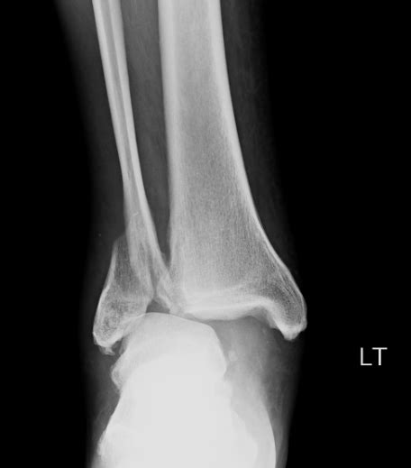 Ortho Blog - CMC COMPENDIUM