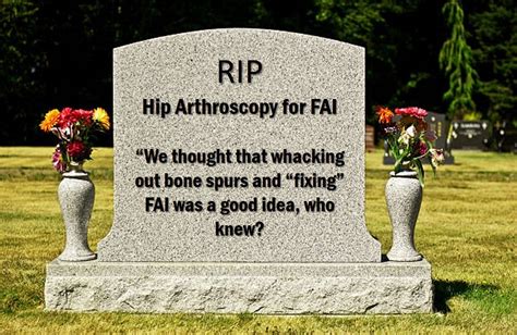 RIP FAI Hip Impingement Surgery? - Regenexx Blog