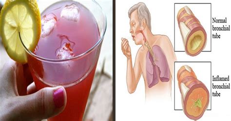 Get Rid of Mucus Congestion and Sinus Problems with this Recipe ...