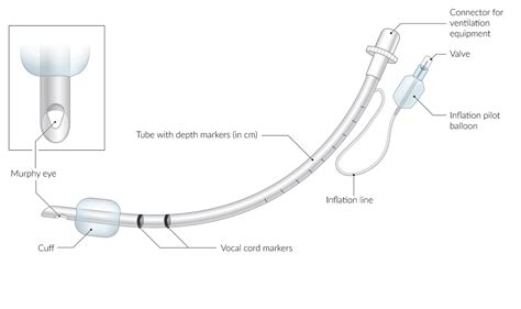 Endotracheal Intubation Equipment