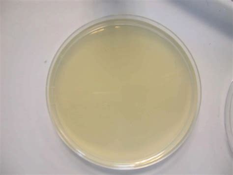 Nutrient Agar : Composition, Preparation and Uses