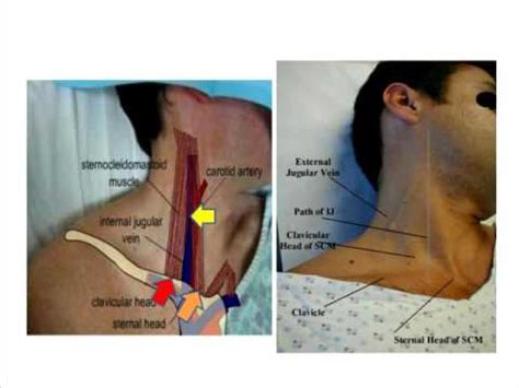 Jugular Vein Anatomy - Anatomical Charts & Posters