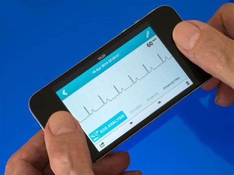 Top 6 EKG Apps Available in App Store — SonoHealth.com