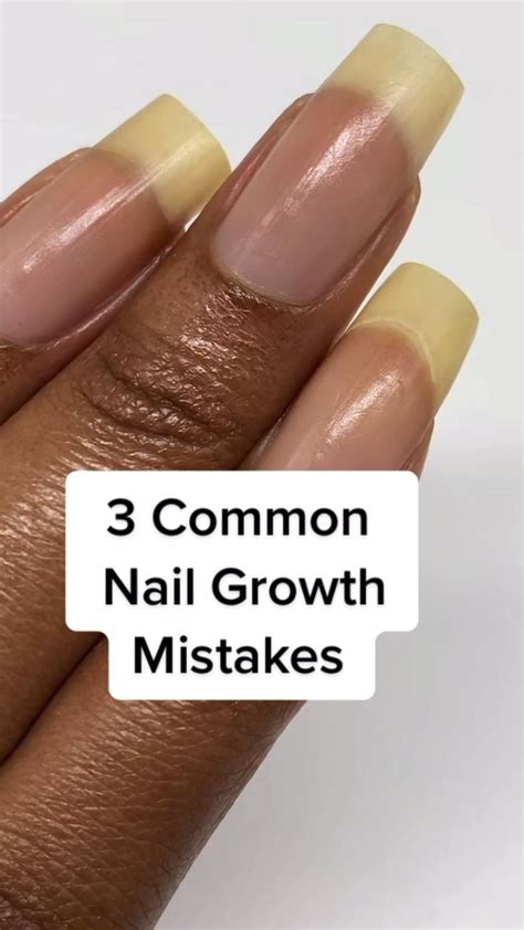 3 Common Nail Growth Mistakes | How to grow nails, Nail growth, Nail care