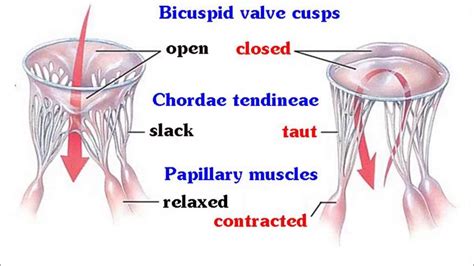 Papillary Muscles And Chordae Tendinae Pulmonary | My XXX Hot Girl