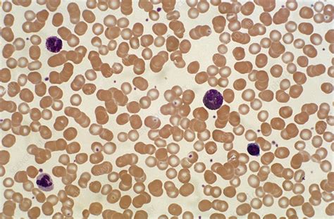 Normal Blood Smear (LM) - Stock Image - C022/2202 - Science Photo Library