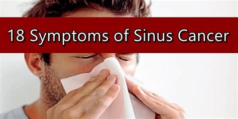 Sinus Cancer Symptoms | NewsFeed