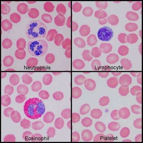 normal blood smear | Medical Laboratories