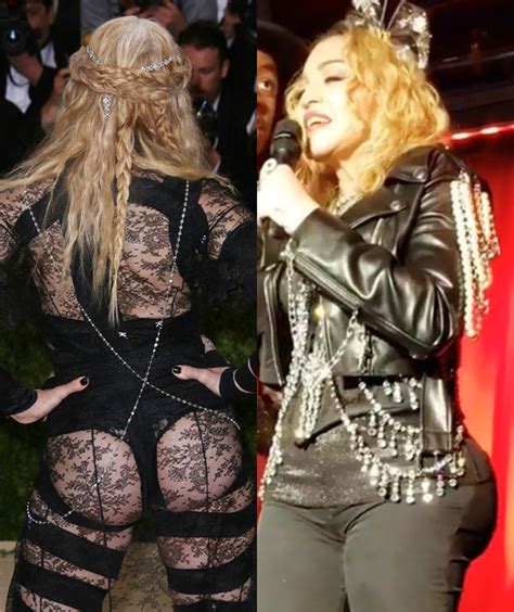 Madonna & Plastic Surgery: Doctors Talk About Possible Butt Implants – Hollywood Life