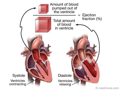 Ejection Fraction – Medmovie.com