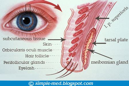 The Patient's Guide to Dry Eye Syndrome: Meibomian Gland Dysfunction ...