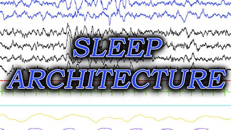 VIDEO: Sleep Architecture - UCSD-TV - University of California Television, San Diego