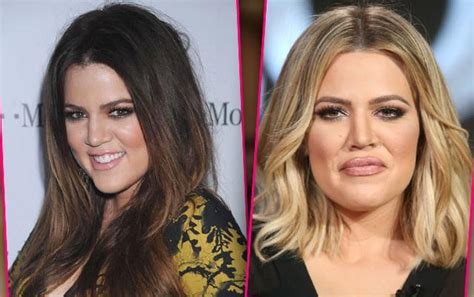 Nothing To Smile About! Khloe Kardashian 'Miserable' Over Plumped Lips