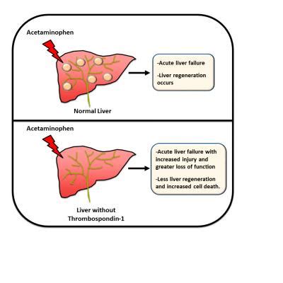 Scientists find new therapy target for drug-induced liver failure – BIOENGINEER.ORG