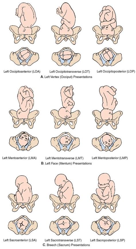 Fetal Position Diagram | Quizlet