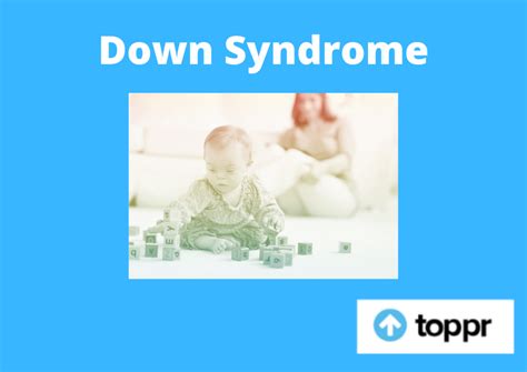 Down Syndrome: Trisomy 21, Down Syndrome Symptoms