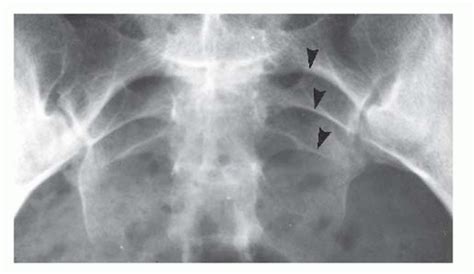 Pelvis, Including Lower Urinary Tract Trauma | Radiology Key