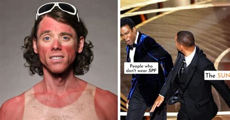 10 Memes That Only People Who Sunburn Will Understand