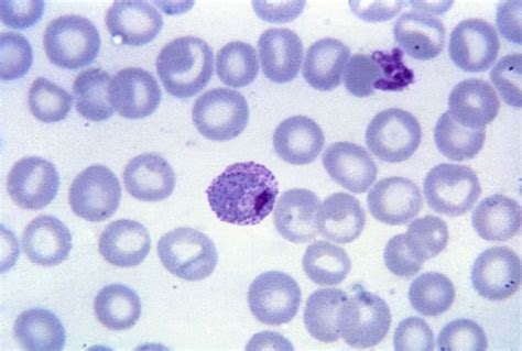 Free picture: micrograph, mature, plasmodium vivax, trophozoite