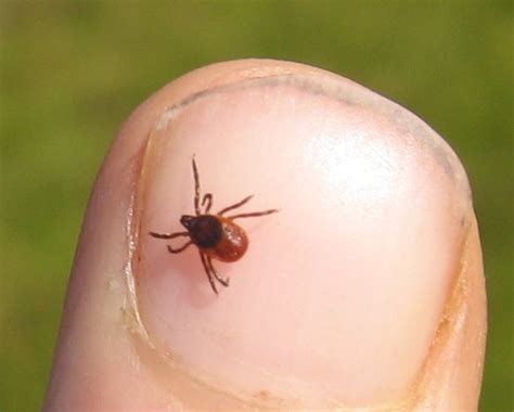 A rare but deadly tick-borne disease has appeared in N.J. Here’s what you need to know.