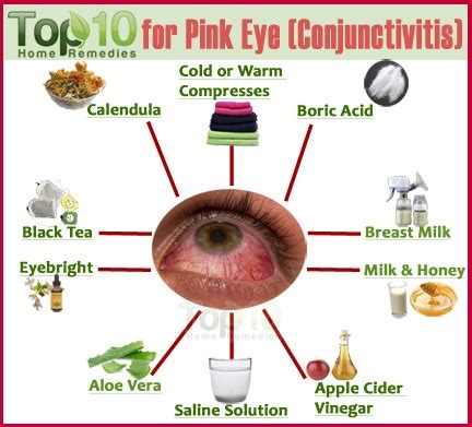 Home Remedies for Pink Eye (Conjunctivitis) | Top 10 Home Remedies