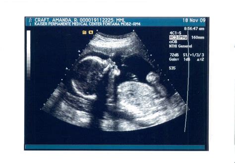 the craftys: 22 Weeks and another Ultrasound!