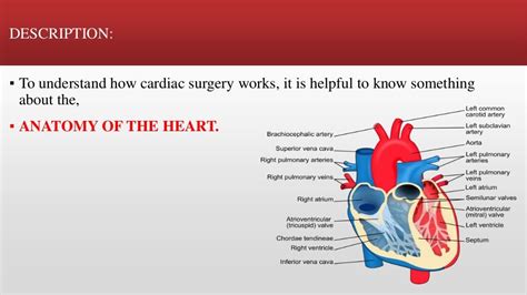 Cardiac surgery