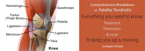 Jumper's Knee (Patellar Tendonitis) - Causes & Treatments | RunnerClick