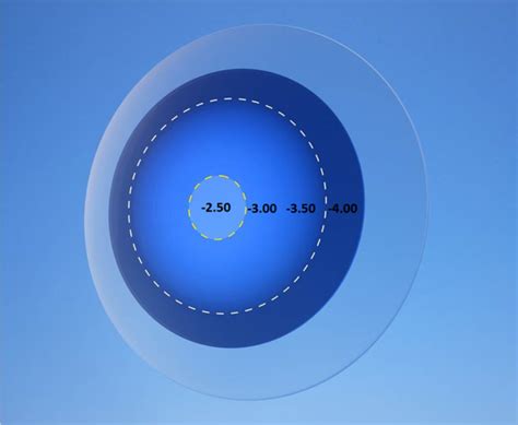 A Systematic Strategy to Fit Toric Multifocal Contact Lenses