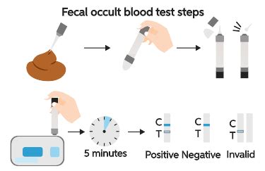 Stool Examination:- Part Stool For Occult Blood, OB, 41% OFF