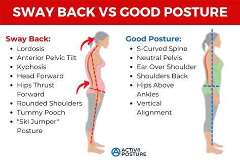 Sway Back - Activ8 Posture