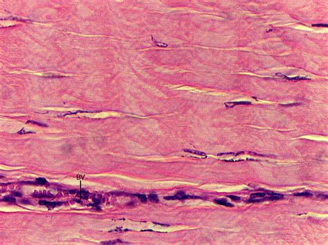 Tendon Histology Labeled