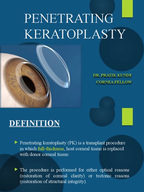 Penetrating Keratoplasty Steps | PDF | Cornea | Surgical Suture