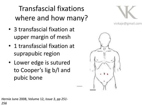 Suprapubic hernia - Unique Features