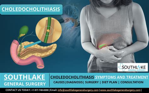 Choledocholithiasis, gallstones, bile duct gallstones, gallbladder, surgery