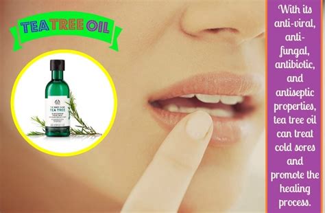 27 Best Home Remedies For Cold Sores On Lips And In Mouth