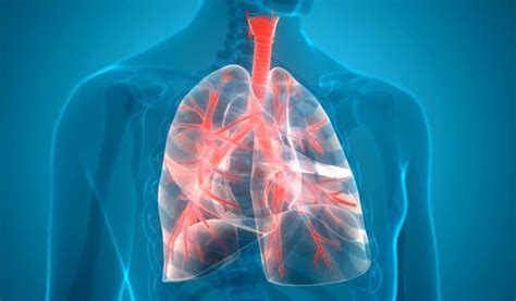 The Four Stages of COPD Explained - A Detailed Overview