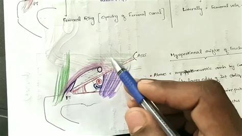 Myopectineal Orifice