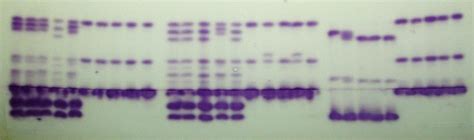 Isozymes: Application for Population Genetics | IntechOpen