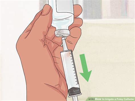 How to Irrigate a Foley Catheter (with Pictures) - wikiHow