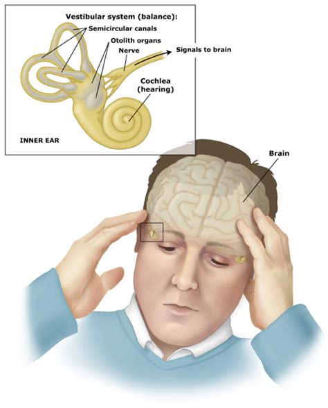 Vestibular Physiotherapy - Physio In Motion