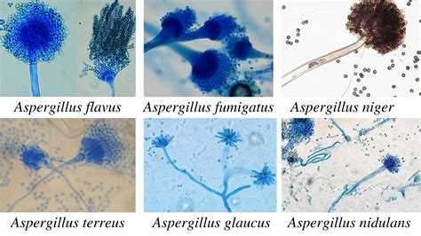 Aspergillus: Morphology, Clinical Features, and Lab Diagnosis • Microbe ...