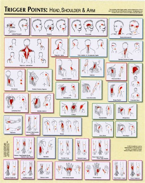 Trigger Point Charts - Clinical Charts and Supplies