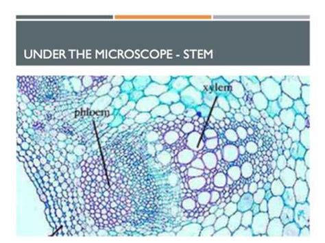 MAB 9.2.2.S6 xylem and phloem under microscope - YouTube