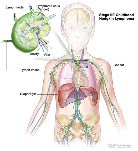 Diseases of the Lymphatic System - Lymphatic system