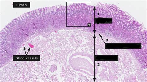 Anatomy 2 Lab Quiz 4/8 Digestive System Flashcards | Quizlet