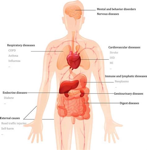 Overview of diseases associated with various human body systems ...